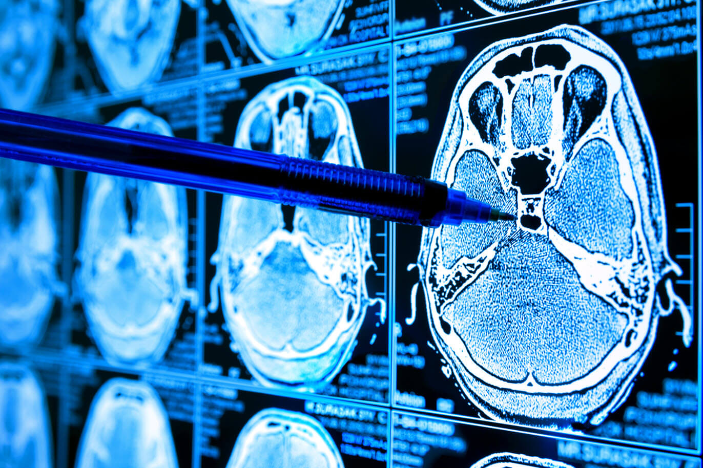 MedVision diagnostic support